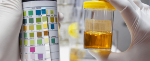 Understanding How Water Helps Decrease Protein Levels in Urine